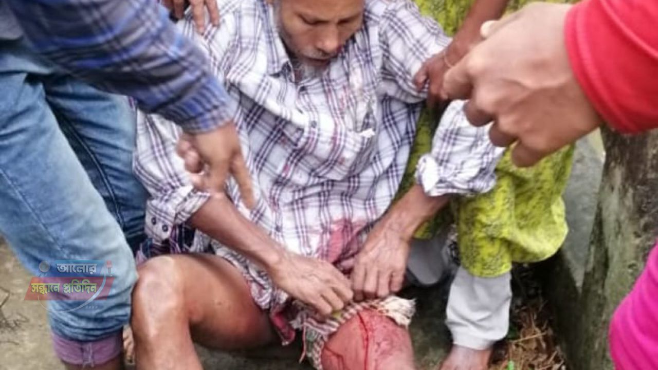 ওসমানীনগরে ঝাপার খালে মাছ ধরা নিয়ে সংঘর্ষ, আহত ৭